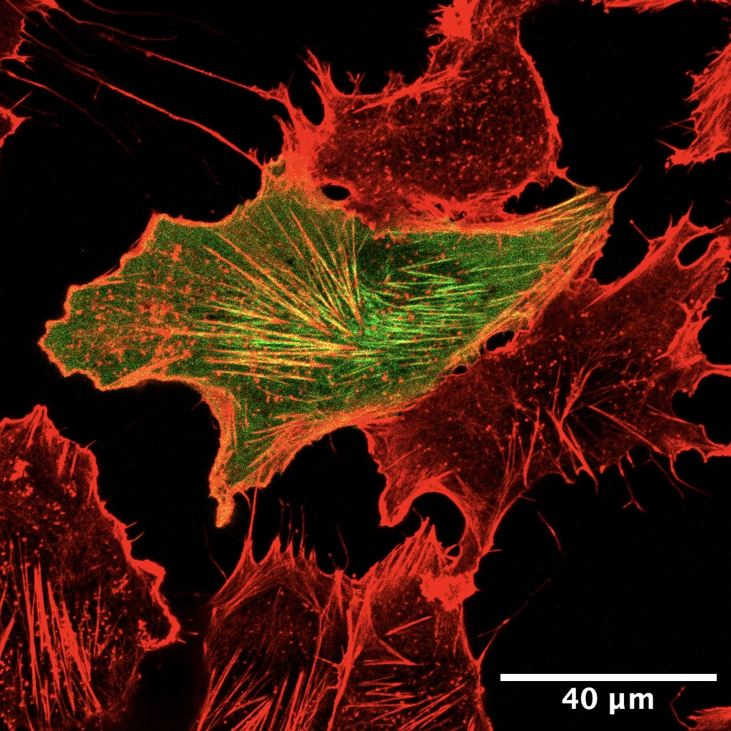 HeLa cell stained for Phalloidin (red) and BORG3 (green)